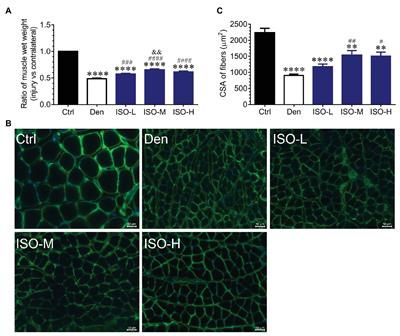 Isoquercitrin Delays Denervated Soleus Muscle Atrophy by Inhibiting Oxidative Stress and Inflammation